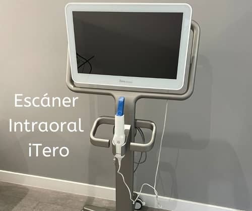 Escáner Intraoral iTero
