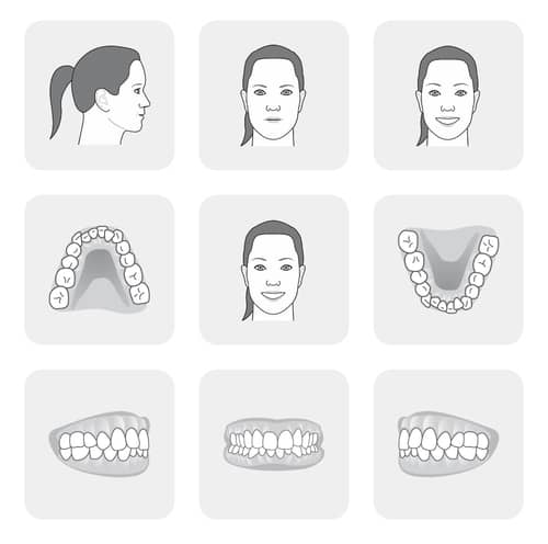 ejemplo de sonrisa para valorar ortodoncia