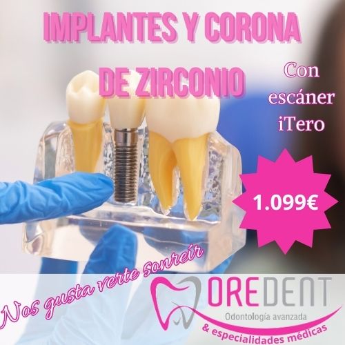 Promoción en implantes con corona de zirconio